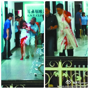 深圳一医院4名医护人员被砍