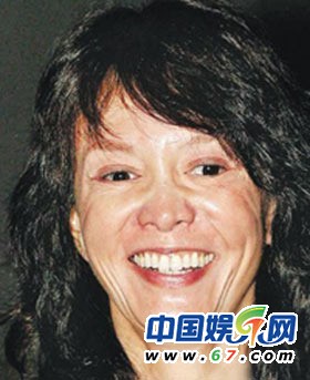 整容女星之凹凸脸