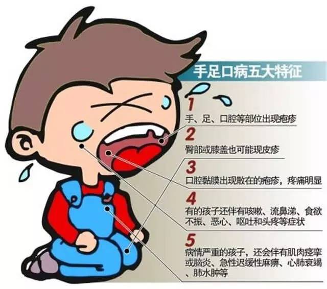 衛生部關於將手足口病納入法定傳染病管理的通知